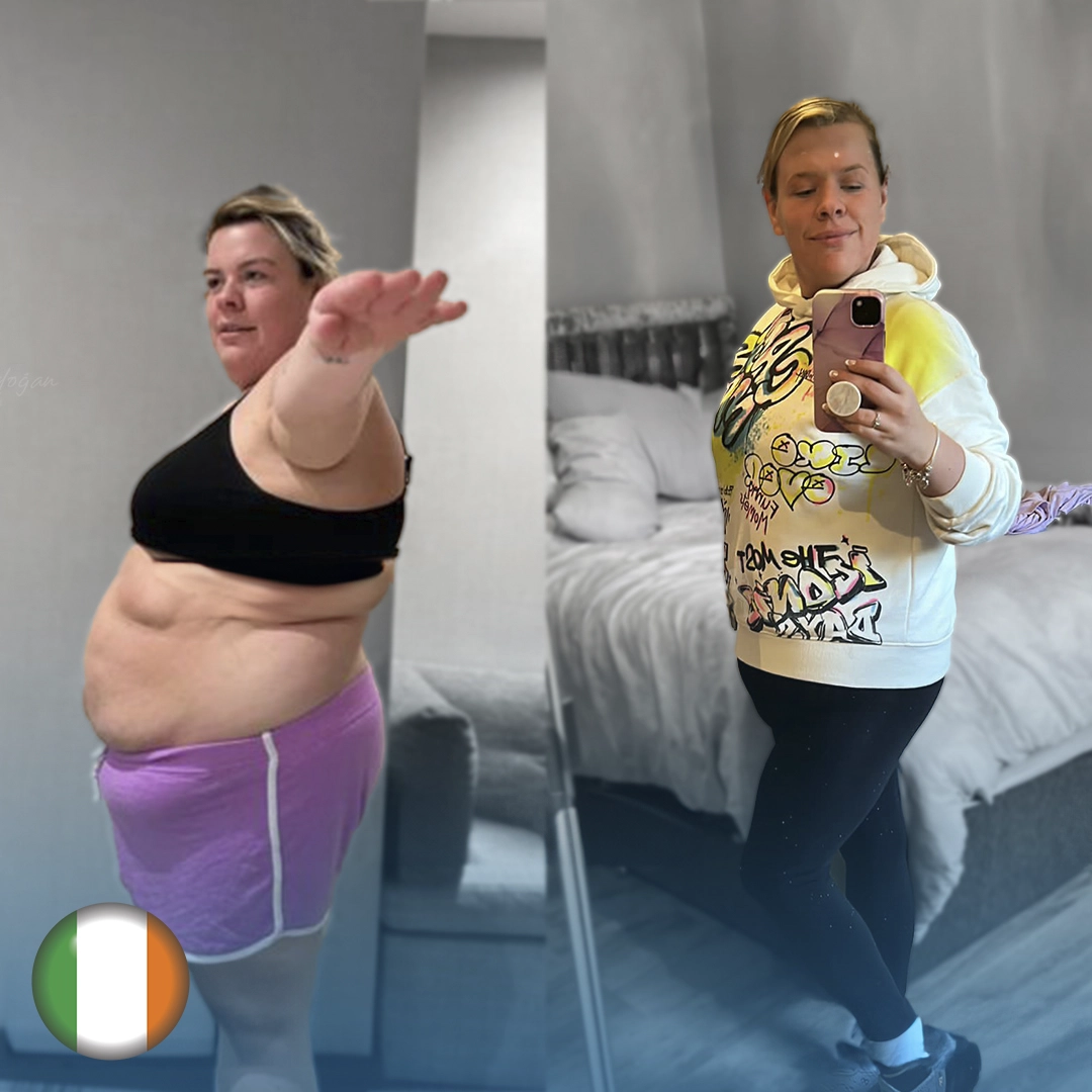 arpanu-bariatric-weight-loss-results.webp
