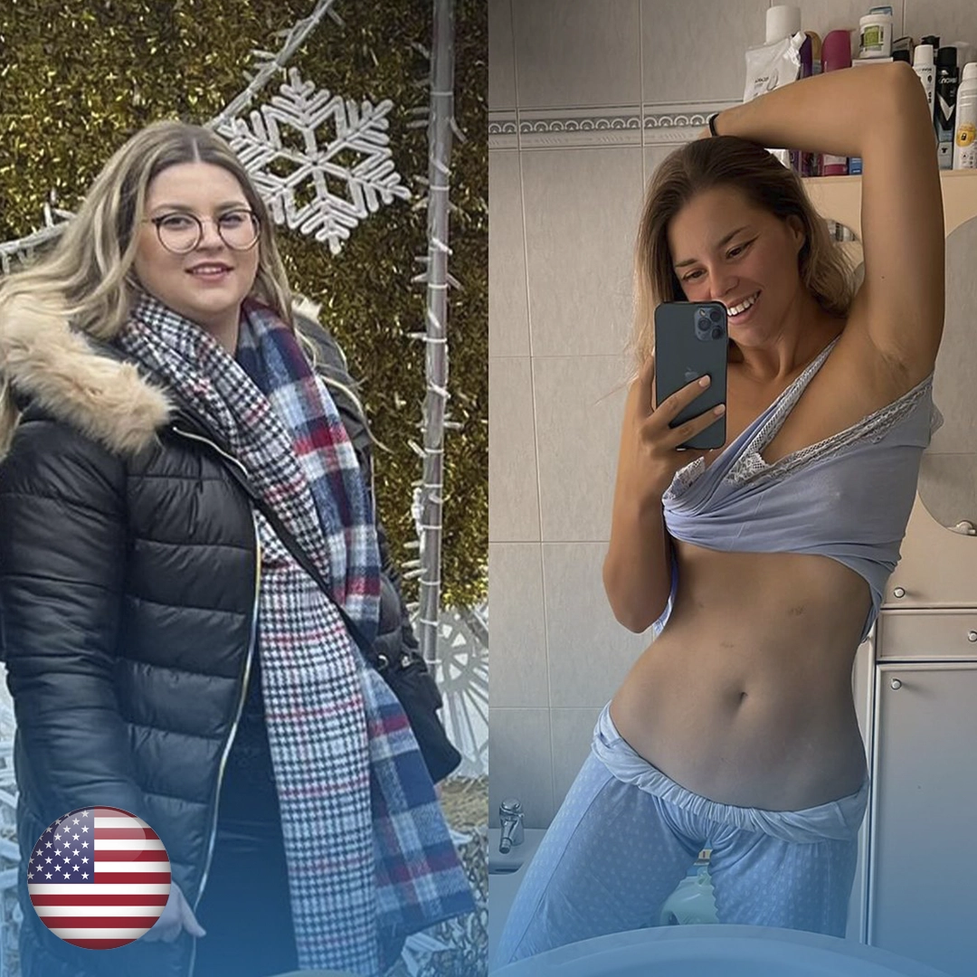 weight-loss-arpanu-bariatric-before-and-after.webp